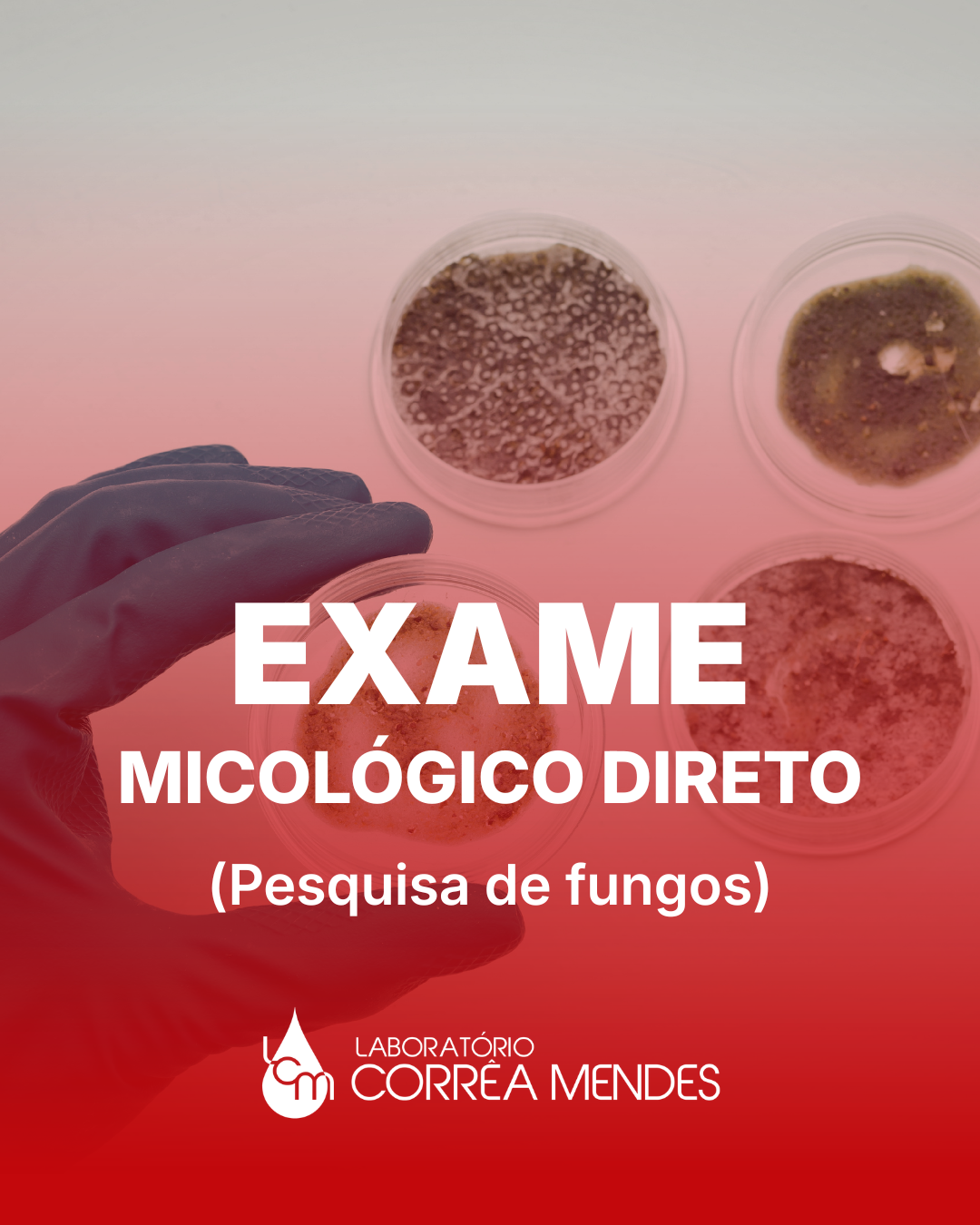 EXAME MICOLOGICO DIRETO - PESQUISA DE FUNGOS
